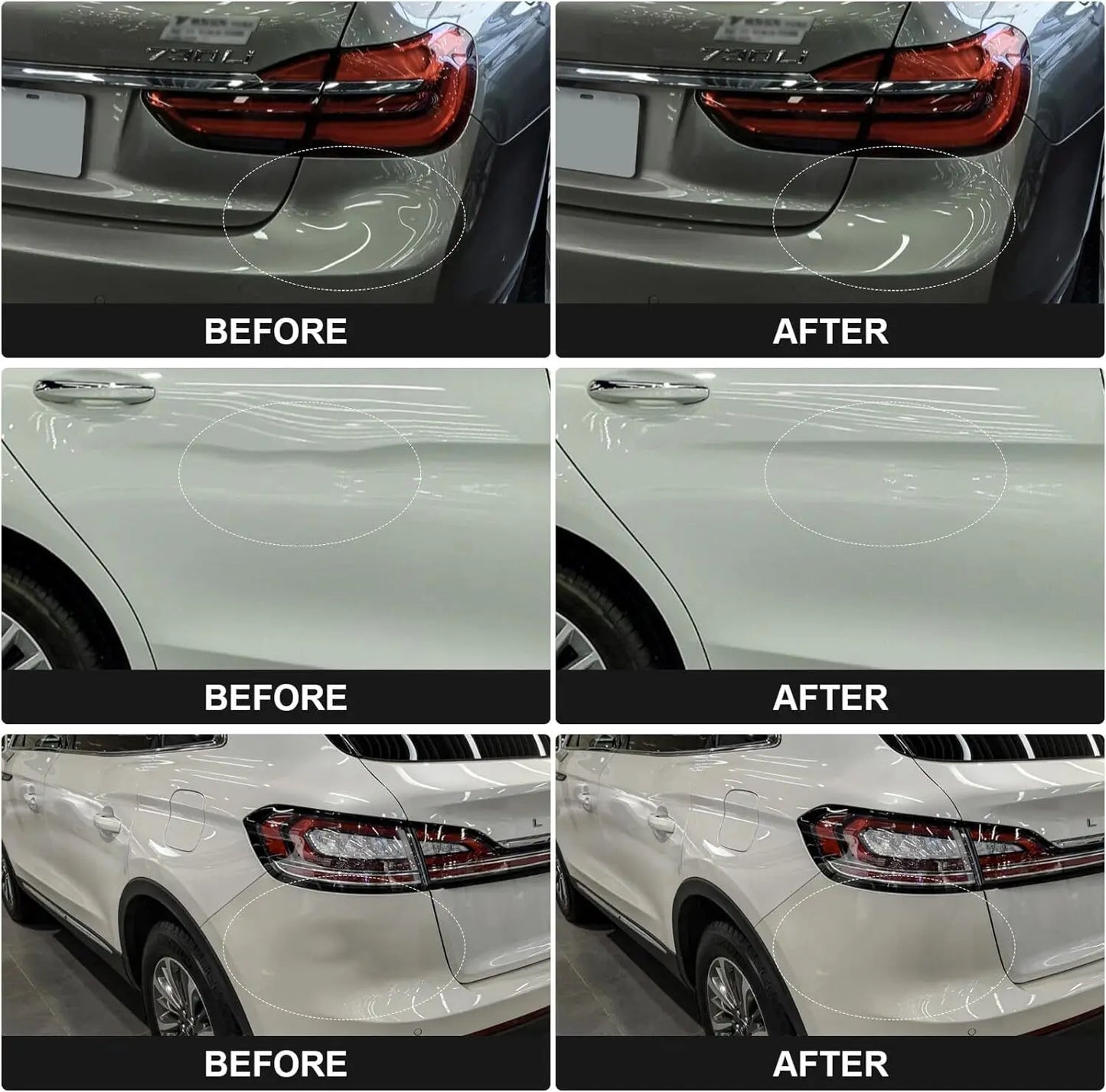 Auto Body Dent Removal Kit
