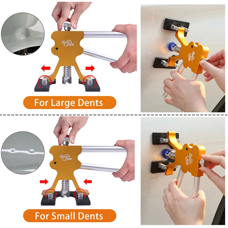Auto Body Dent Removal Kit