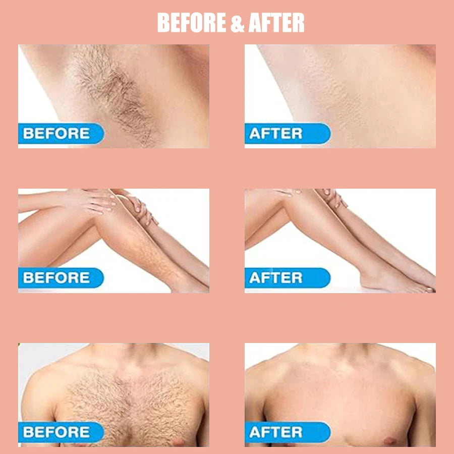 Hair Removal Foam Spray