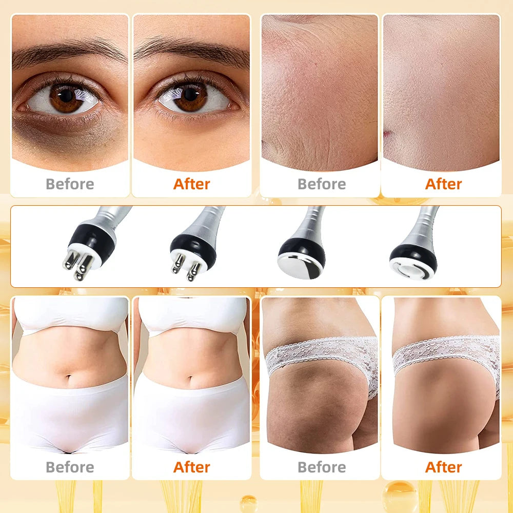 4 in 1 Cavitation Ultrasonic RF Slimming Machine