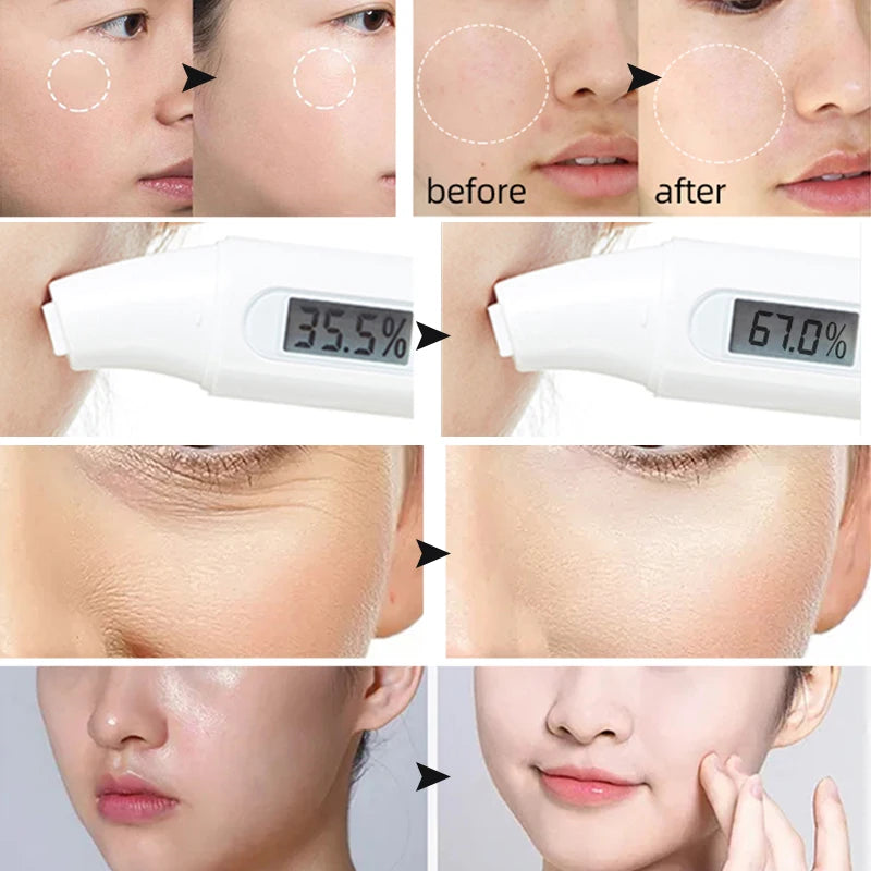 Hyaluronic Acid Rubber Petal Rose Peel